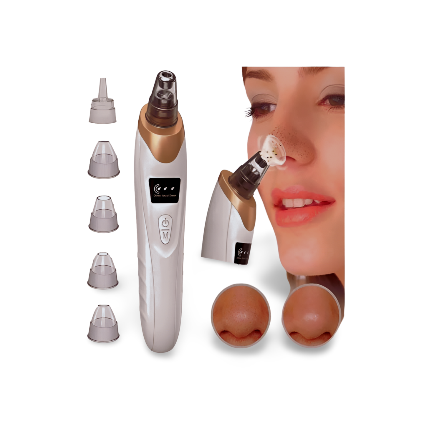 Black Head Removal Machine